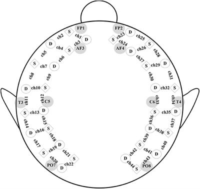 Variations of the Functional Brain Network Efficiency in a Young Clinical Sample within the Autism Spectrum: A fNIRS Investigation